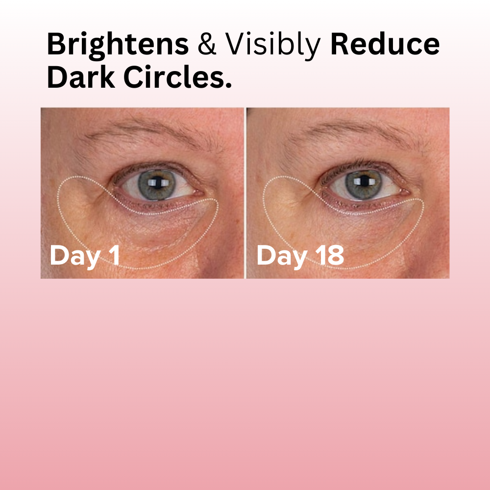 Revive & Glow Vitamin C Eye Balm