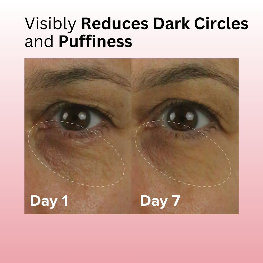 Revive & Glow Vitamin C Eye Balm