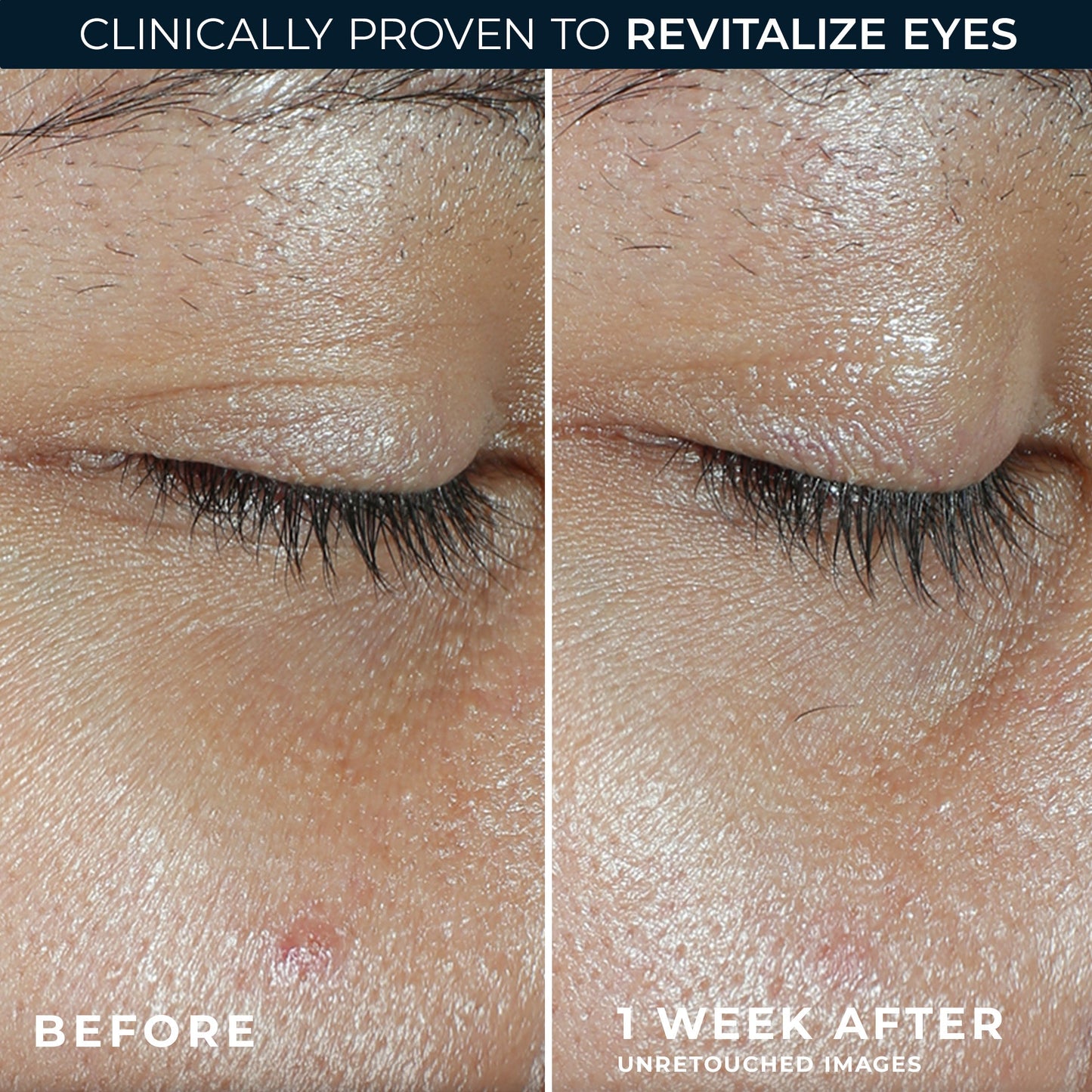 Revive & Glow Vitamin C Eye Balm