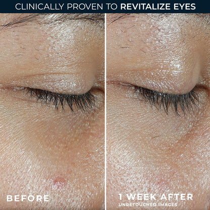 Revive & Glow Vitamin C Eye Balm
